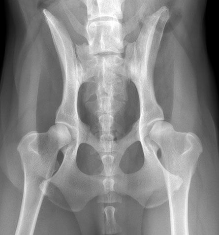 Normale Hüfte ohne Arthrose